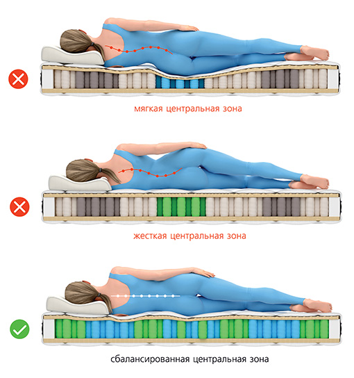 Матрасы при заболевании позвоночника